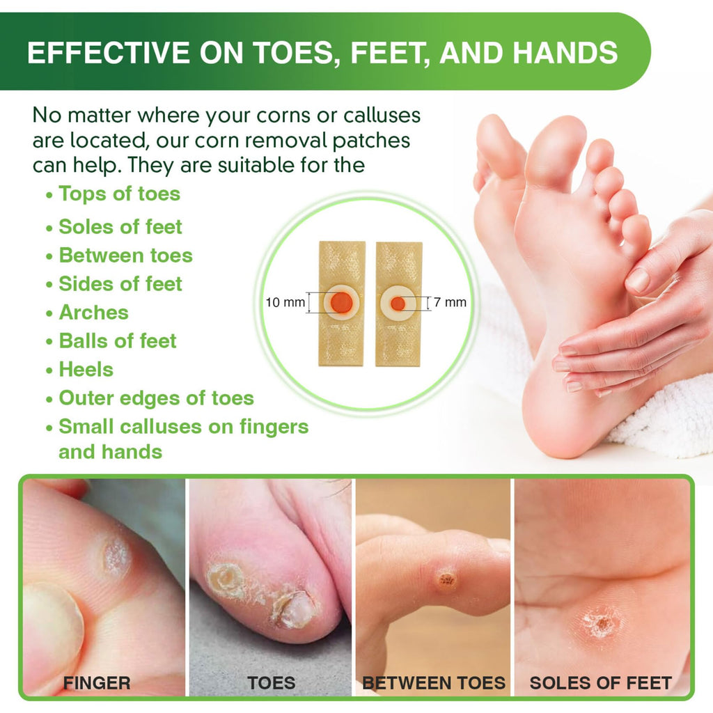 Corn Remover Pads for Feet Toes: 30 Pack 40% Salicylic Acid Extra Strength Treatment - Fast Effective Medicated Bandages for Adu