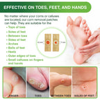 Corn Remover Pads for Feet Toes: 30 Pack 40% Salicylic Acid Extra Strength Treatment - Fast Effective Medicated Bandages for Adu