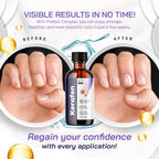 LIVORKA (3 Pack) Kerafen Toenail Liquid, Kerafen, Kerafen for Toenail, Kerafen Bottle, Kerafen Drops, Kerafen Drops for Nails, K