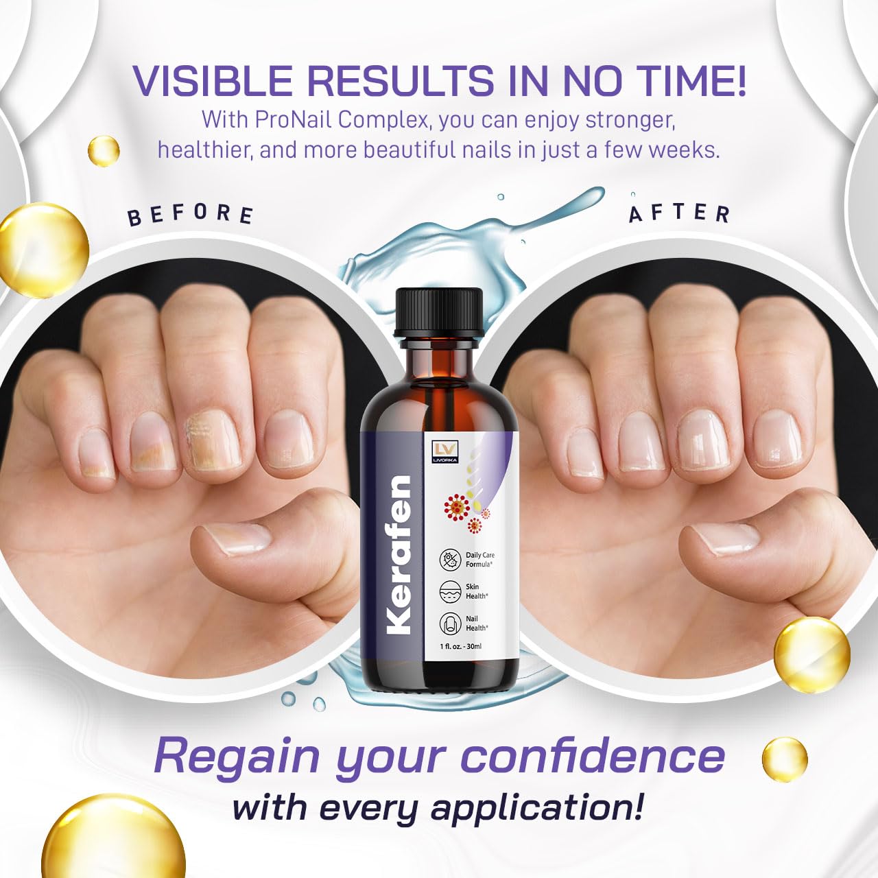 LIVORKA (3 Pack) Kerafen Toenail Liquid, Kerafen, Kerafen for Toenail, Kerafen Bottle, Kerafen Drops, Kerafen Drops for Nails, K