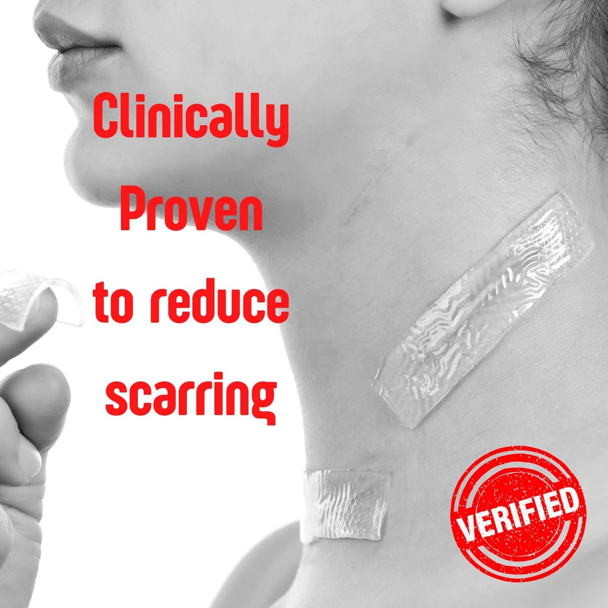 SilverSeal Burn and Wound Dressing | Hydrogel Pads with X-Static Silver | Soothing, Moist & Protective | Burns, Cuts & Wounds |