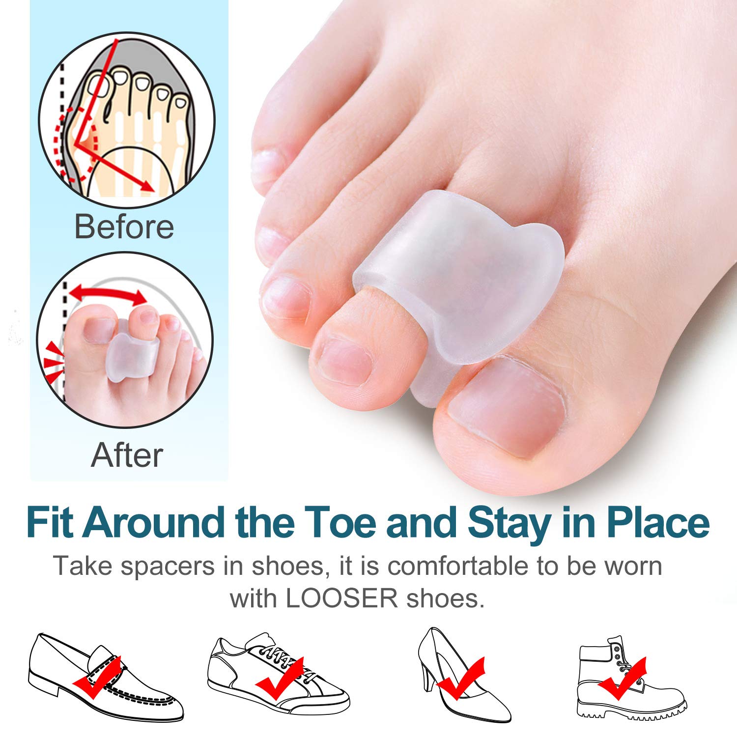 Povihome 10 Pack Clear Toe Spacers, Big Toe Separator (1st/2nd Toe), Bunion Corrector to Correct Big Toe Bunion, Overlapping Toe