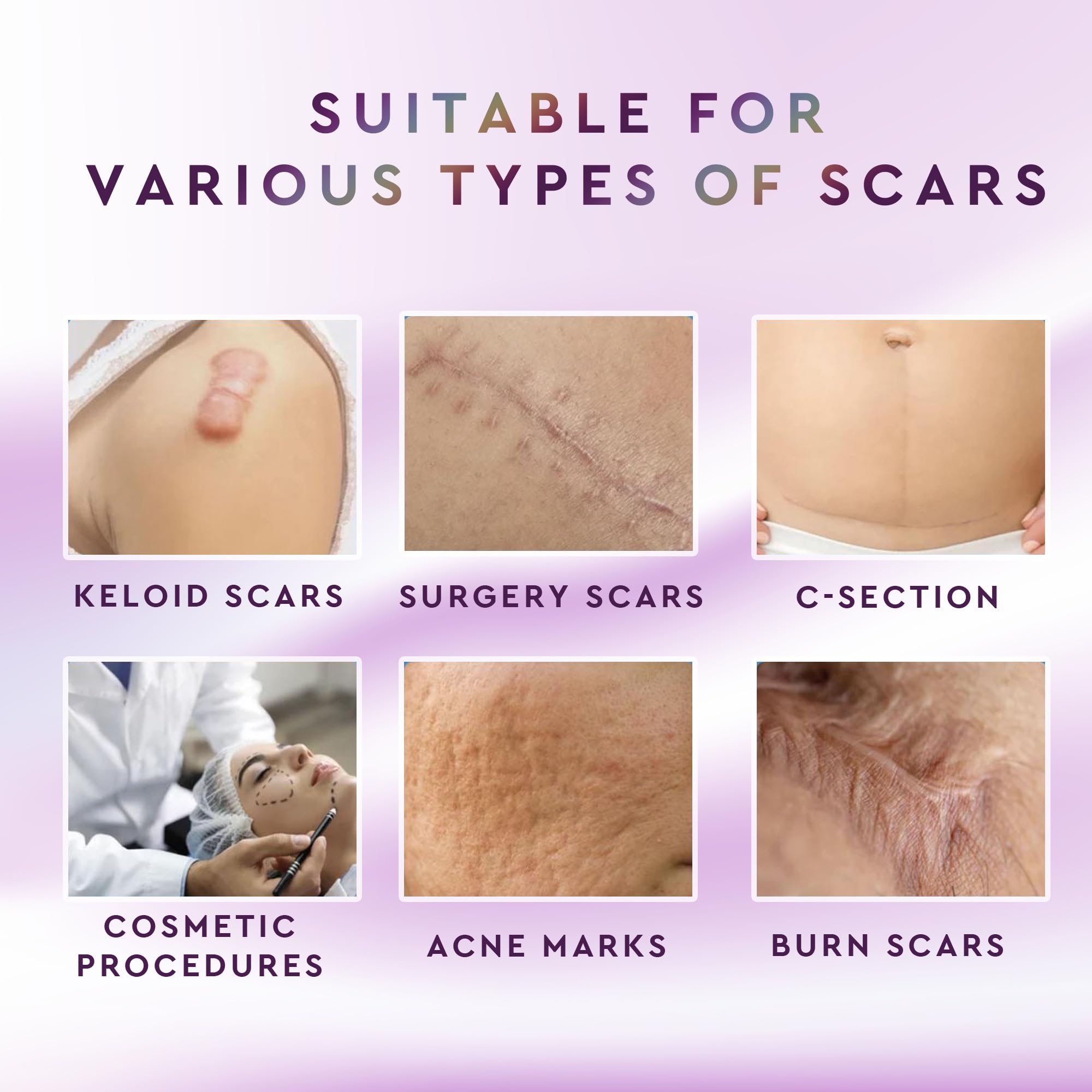 Advanced Silicone Scar Removal Cream for Keloid Bump Removal, Must have Gel for C Section, Hysterectomy, Mastectomy, Tummy Tuck,