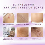 Advanced Silicone Scar Removal Cream for Keloid Bump Removal, Must have Gel for C Section, Hysterectomy, Mastectomy, Tummy Tuck,