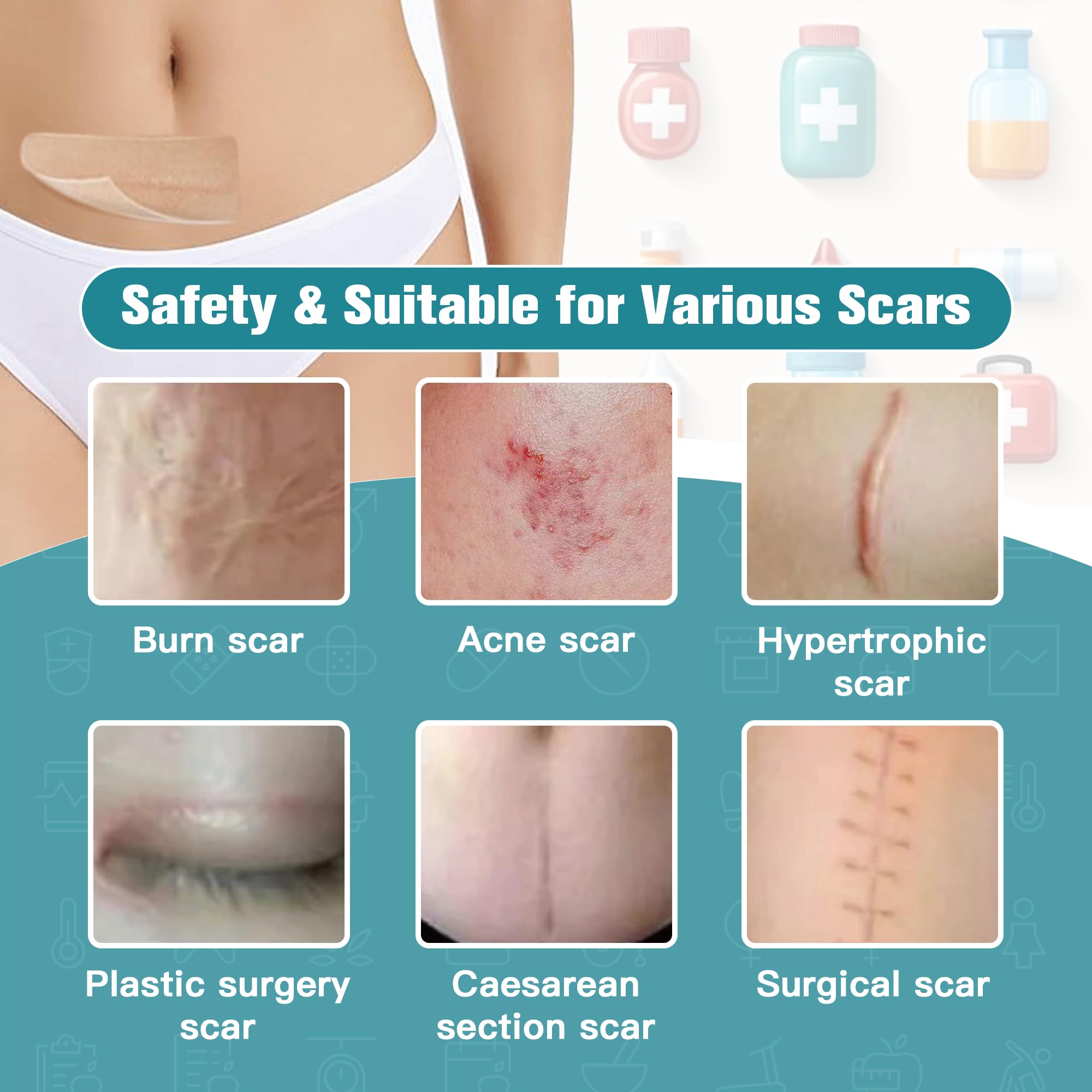 Silicone Scar Sheets,Silicone Scar Tape For Surgical Scars,0.55mm Thicked Silicone Scar Removal Strips For Surgical,C-Section,Tu