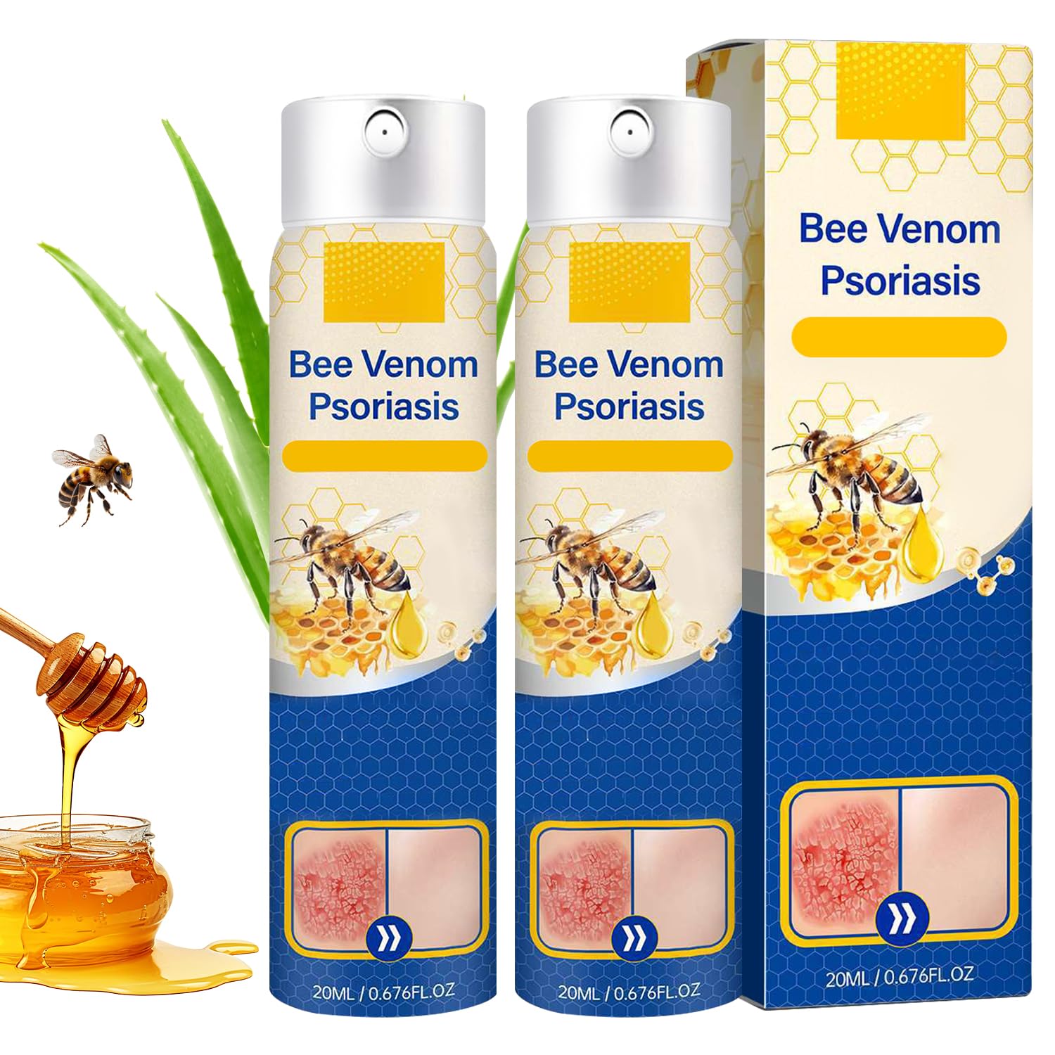 cuoct 2 PCS PsoriaHeal Bee Venom Psoriasis Treatment Spray, Psoriasis Relief Spray, Bee Venom Psoriasis Spray, Pure Natural Bee 