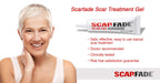Scarfade Silicone Scar Gel for Scar Repair, Scar Treatment - 15g Tube