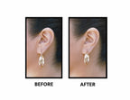 Lobe Wonder Ear Repair, pack of 6