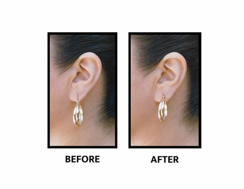 Lobe Miracle Support Patches for Earrings 60 ea (Pack of 4)