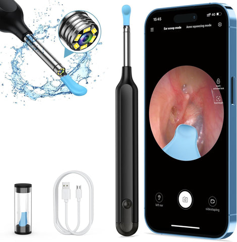 Earwax Camera Ear Camera Otoscope Cleaner, Oxbird 1080P Wireless Ear Wax Removal Kit Smart Ear Cleaner with Camera and Light for