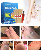 MYMULIKE 48Pcs Corn Removers for Toes & Feet, Tackle Tough Corns with Ease, 0.4 Diameter Large Size, Experience Quick Recover wi
