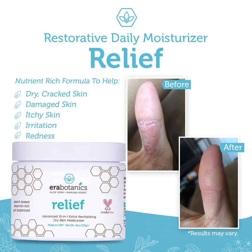 Era Organics Eczema, Psoriasis & Dermatitis Moisturizer Cream - Advanced 13-in-1 Non-Greasy Face or Body Lotion for Dry, Itchy S