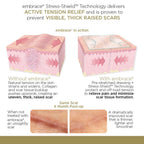 Embrace Active Scar Defense for New Scars, FDA-Cleared Silicone Scar Sheets, 6.3 Inch, X-Large, 30 Day Supply - Packaging May Va