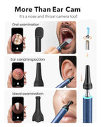 Bebird M9 Ear Care Wax Removal Tool Camera Cleaning Kit- Wireless Cleaner Ear Viewing Scope OTO-Scope with Camera & Light - Vide