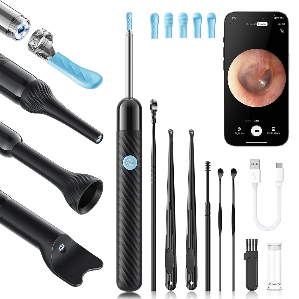 Loyker X6 Ear Wax Removal Tool Camera, Ear Cleaner with Camera, FSA - HSA Store Eligible, 1080P Ear Camera with 6LED Light for E