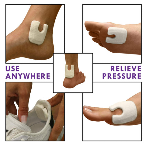 U Shaped Felt Callus Pads - Adhesive Foot Pads That Protect Calluses from Rubbing On Shoes - 3/16'' - 100 Pack