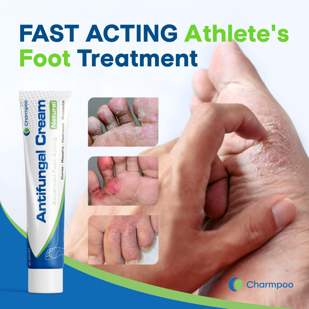CHARMPOO Antifungal Cream for Foot and Body: Fast Relief Athletes Foot Jock Itch Psoriasis Ringworm Eczema Rashes - Powerful He