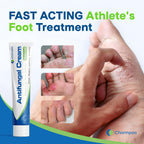 CHARMPOO Antifungal Cream for Foot and Body: Fast Relief Athletes Foot Jock Itch Psoriasis Ringworm Eczema Rashes - Powerful He