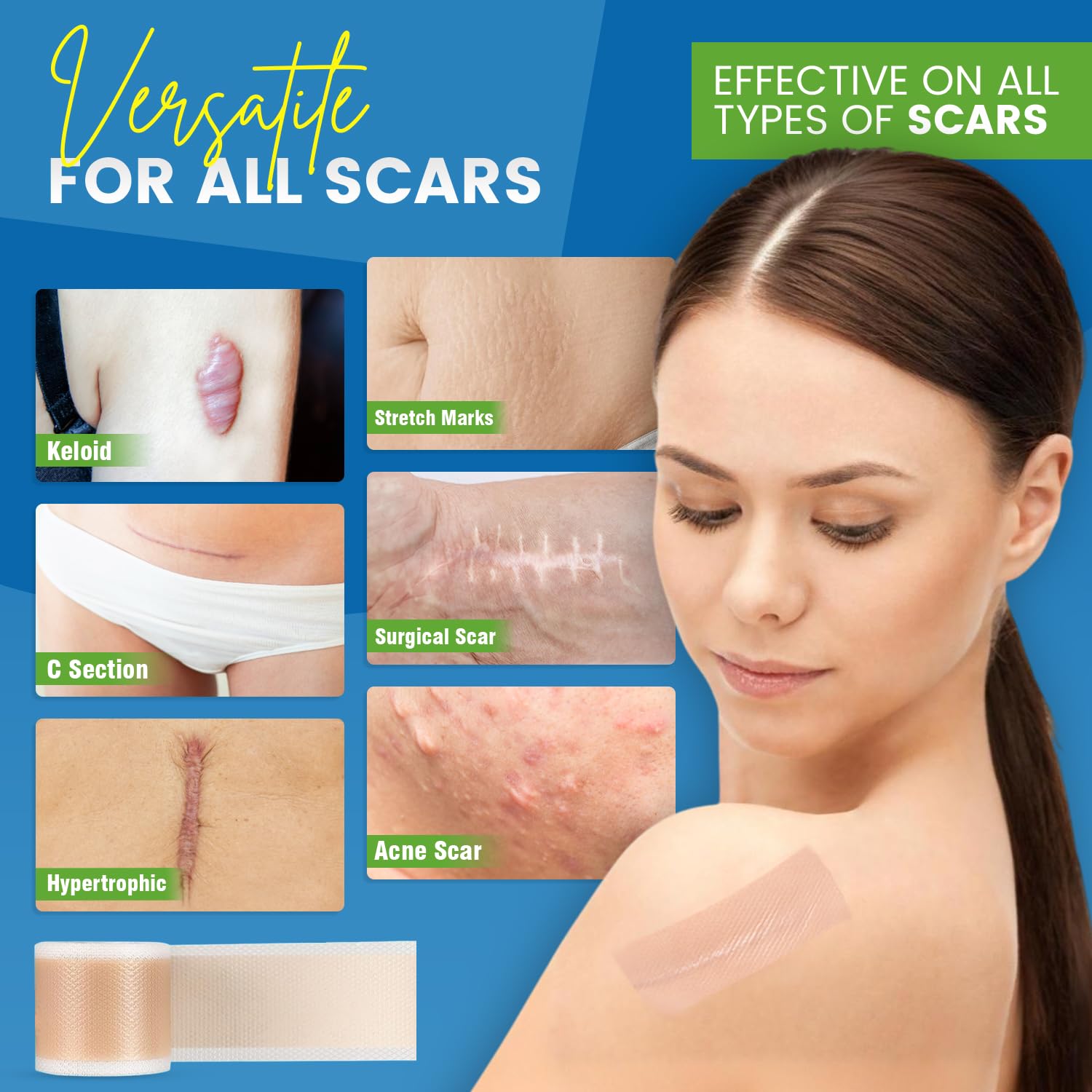 Silicone Scar Sheets,Silicone Scar Tape, (1.6    x 60    Roll, 1.5M) Scar Removal Strips for Surgical Scars,Keloids, C-Section,