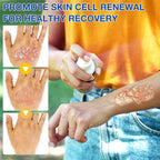 cuoct 2 PCS PsoriaHeal Bee Venom Psoriasis Treatment Spray, Psoriasis Relief Spray, Bee Venom Psoriasis Spray, Pure Natural Bee