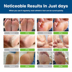 CHARMPOO Antifungal Cream for Foot and Body: Fast Relief Athletes Foot Jock Itch Psoriasis Ringworm Eczema Rashes - Powerful He