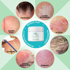 Soothe My Skin Cream for Sensitive Skin - Stocking Stuffers. Eczema Cream Psoriasis Atopic Dermatitis Lichen Sclerosus. Emu Oil