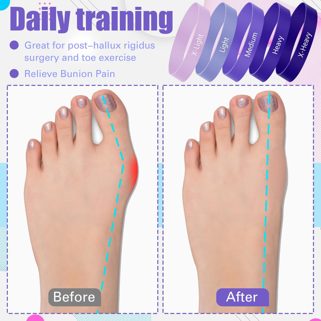 WinnerWhy Set of 5 Toe Stretcher Bands for Bunions Big Toe Exercise Strap Strong Loop Resistance Bands with Carry Bag for Correc