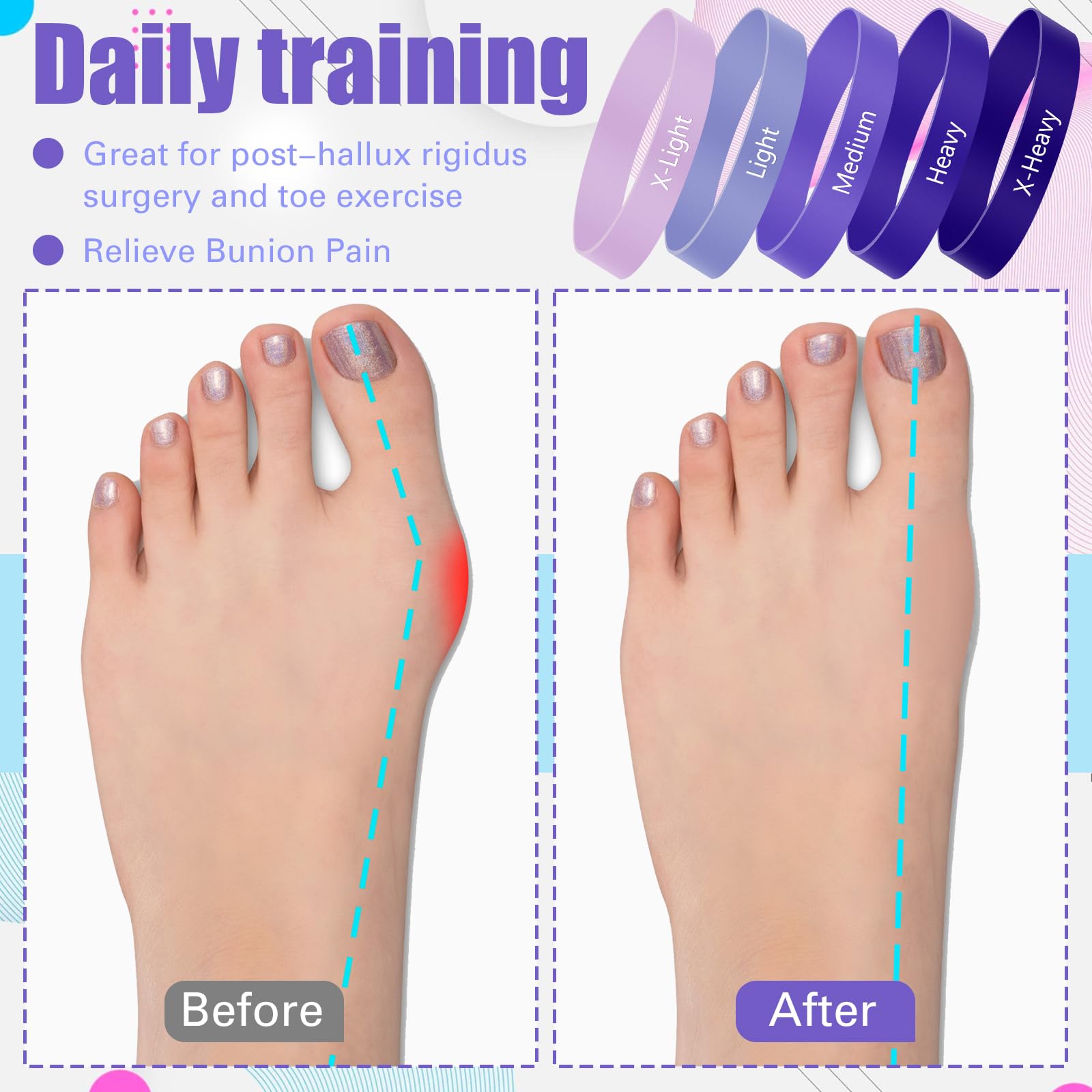 WinnerWhy Set of 5 Toe Stretcher Bands for Bunions Big Toe Exercise Strap Strong Loop Resistance Bands with Carry Bag for Correc
