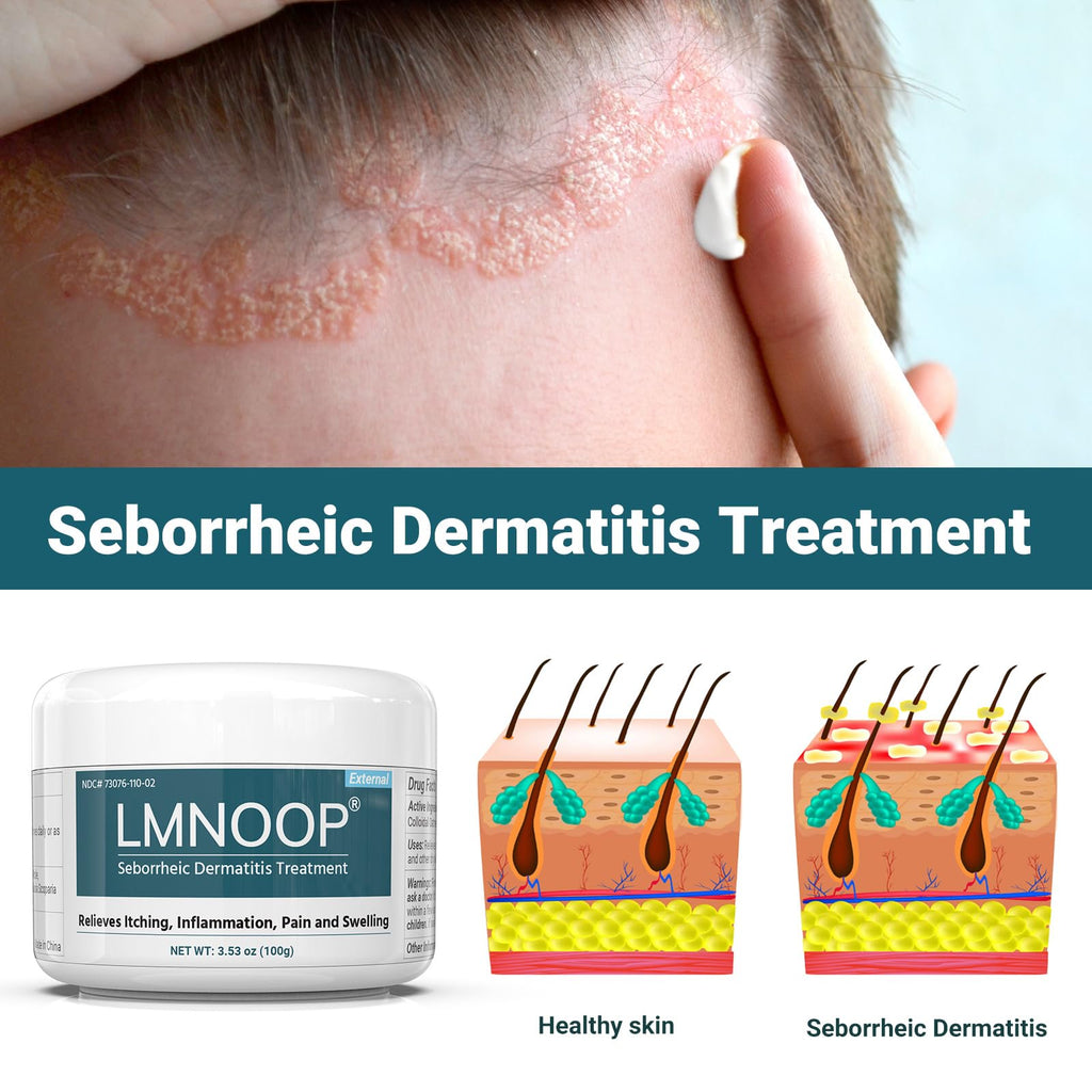 LMNOOP Seborrheic Dermatitis Cream, Extra Strength Scalp Treatment for Psoriasis, Folliculitis, Eczema, Dry Scalp, Dandruff, Ant