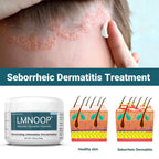 LMNOOP Seborrheic Dermatitis Cream, Extra Strength Scalp Treatment for Psoriasis, Folliculitis, Eczema, Dry Scalp, Dandruff, Ant