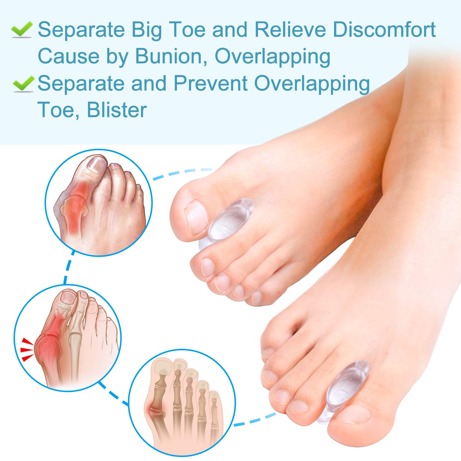 Povihome 10 Pack Gel Bunion Corrector and Toe Spacers Separators and Straightener Orthotics (4/10''Thick) for Sports Activities,