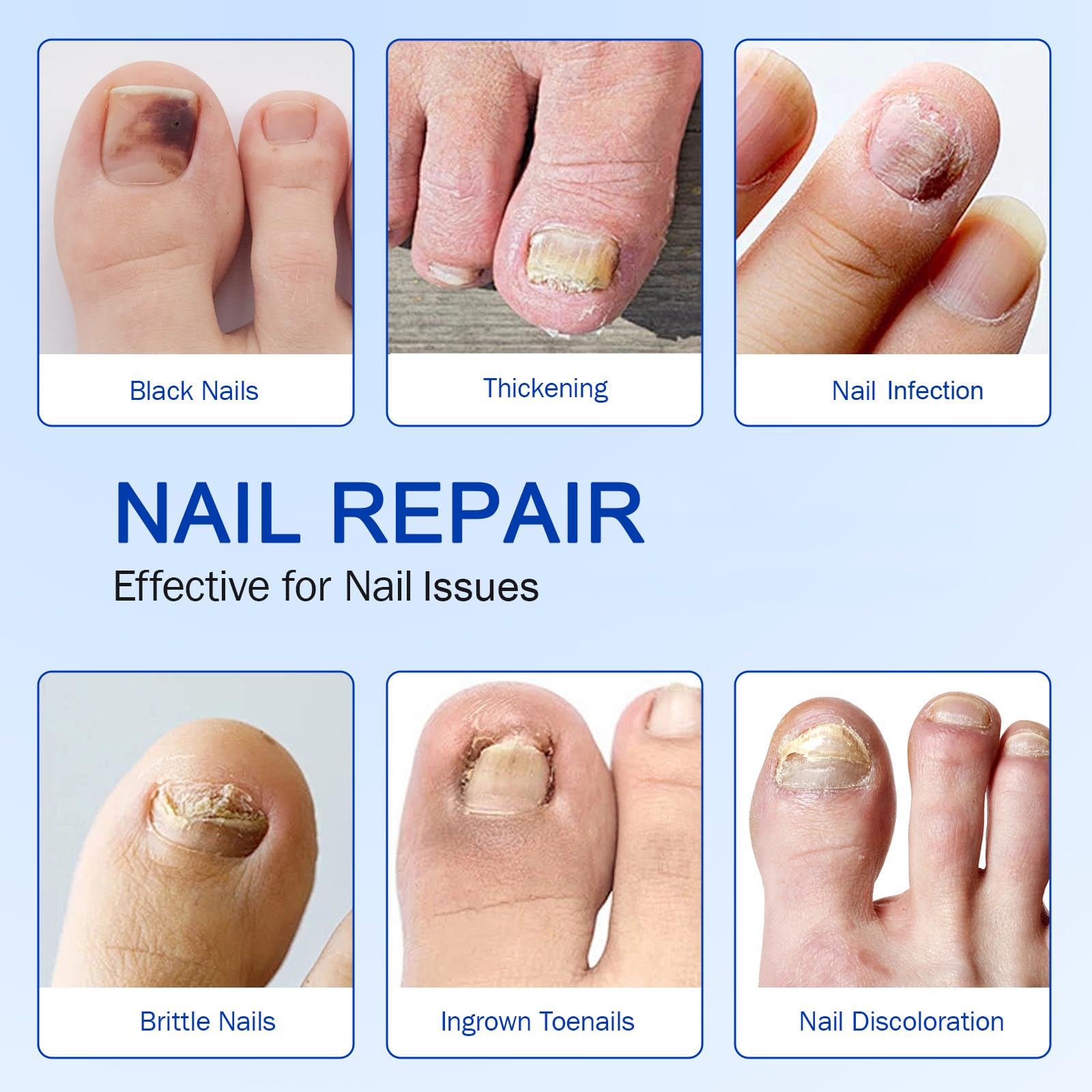 Nail Patches 21 PCS Toenail Treatment Extra Strength 8-Hour Overnight Nail Fast Acting Repair Effortless Hydrogel Nail Care and