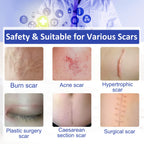 Silicone Scar Sheets (1.6    x 120   ), Clear Gel Silicone Scar Tape, Invisible Medical Grade Scar Silicone Strips, Transparent