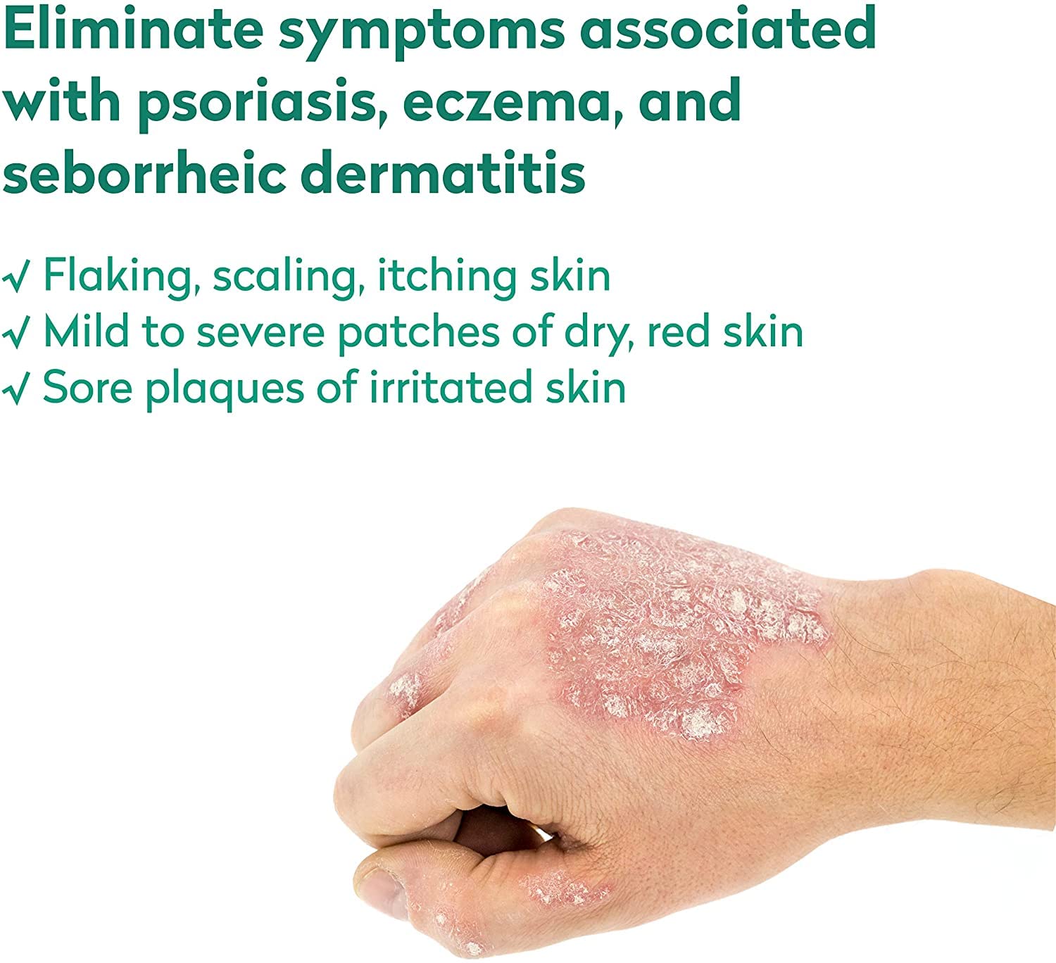 Dr. Blaines REVITADERM Psoriasis Formula - Topical Cream with Coal Tar, Tea Tree Oil and Lavender Oil for Itching, Flaking, Dry,