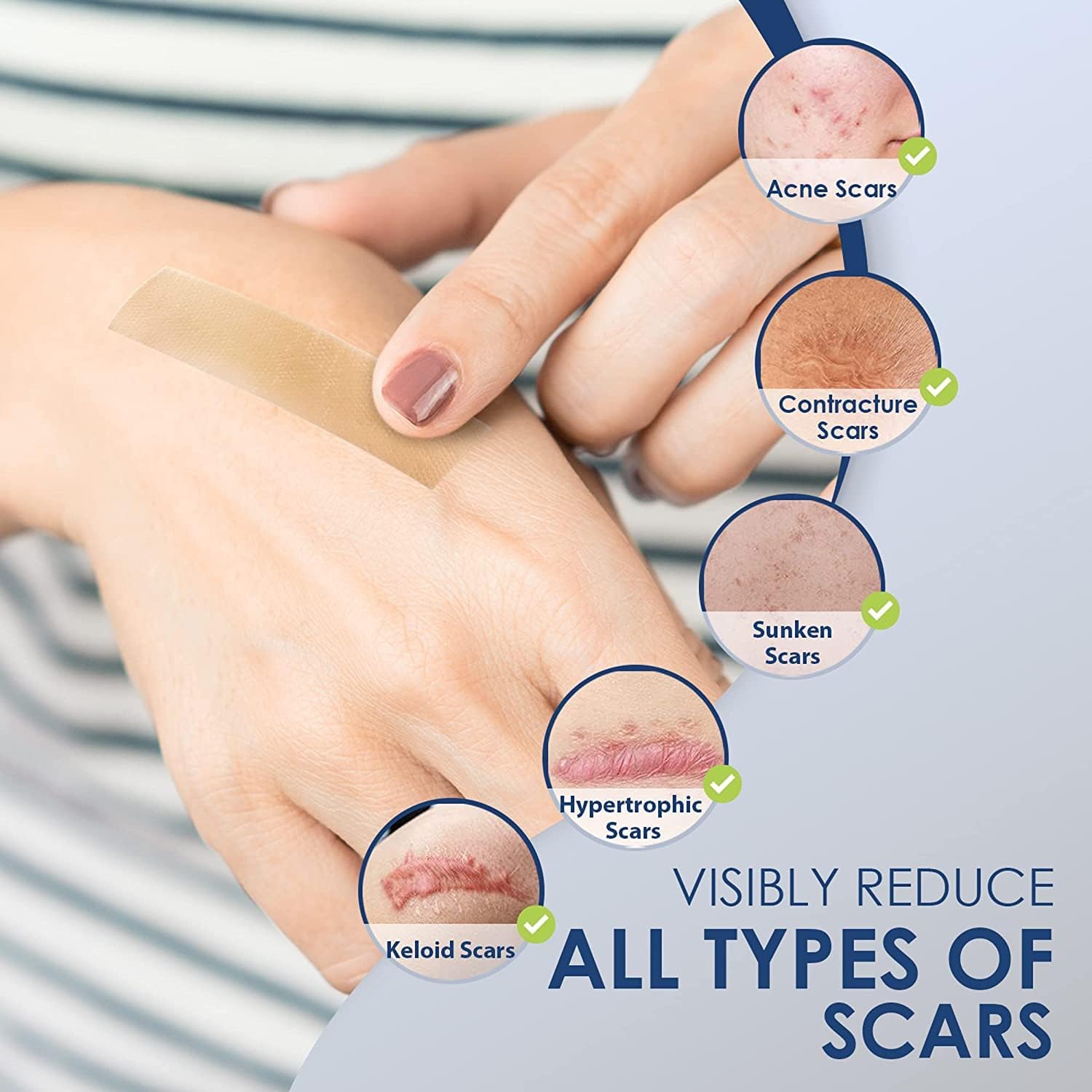 Admirada Scar Sheets, Silicone Patches for Scars, Silicone Scar Strips, Premium Scar Tape for Surgical Scars Removal