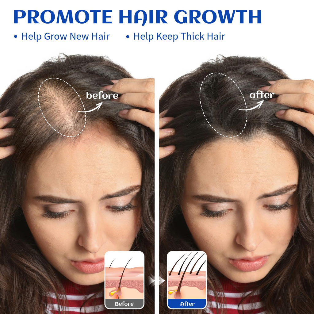 HIQILI Rosemary Oil for Hair Growth, Add to Shampoo & Conditioner, 100% Pure Undiluted - 16 Fl Oz