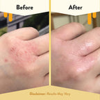 ECZEMA HONEY Original Skin-Soothing Cream - Organic Hand & Body Eczema Relief - Natural Honey Lotion for Dry, Itchy, & Irritable