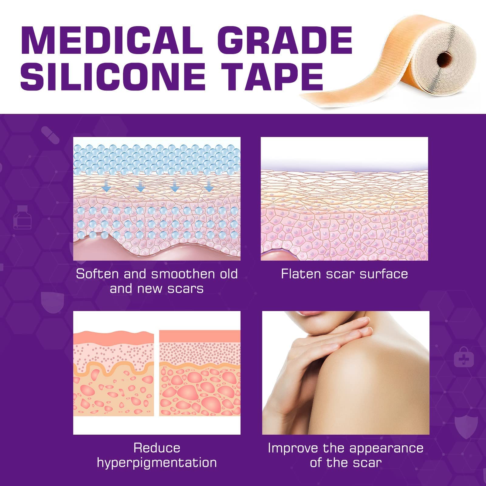Silicone Scar Sheets(1.6'' x 60''Roll-1.5M) - Soft Silicone Gel Scar Tape Painless Silicone Tape Roll - Reusable, Medical Grade