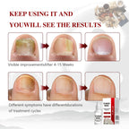 Toenail Fungus Treatment, Herbal Extracts, Nighttime Long-Lasting Nail Treatment, Suitable for Discoloration, Shaped Nails, Thic