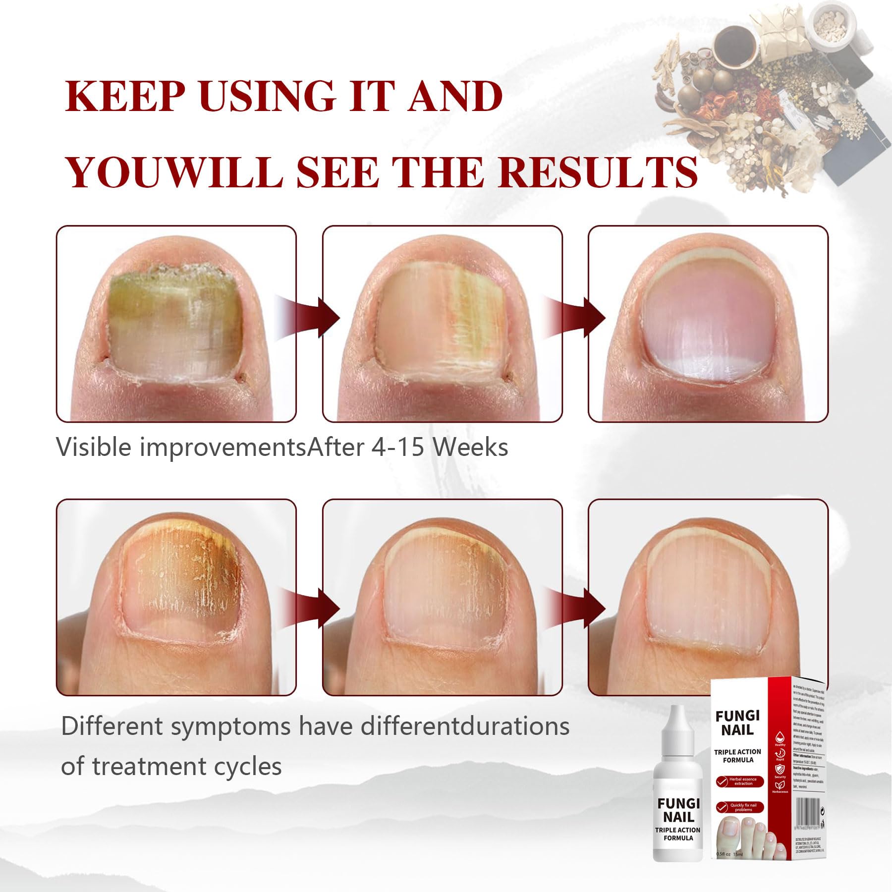 Toenail Fungus Treatment, Herbal Extracts, Nighttime Long-Lasting Nail Treatment, Suitable for Discoloration, Shaped Nails, Thic