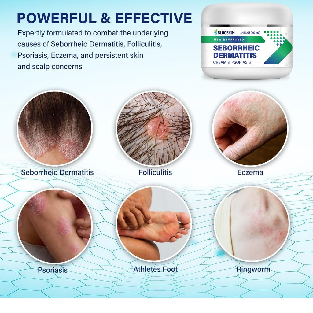 Blooskim Seborrheic Dermatitis Face Cream - Face, Scalp & Body Moisturizing Treatment for Flaky, Itchy Skin - Daily Lotion for P