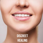 Acculip Cold Sore Patch Lysine Cold Sore Treatment for Lips, Lysine Lip Balm Alternative for Cold Sore Relief, Medicated Fever B