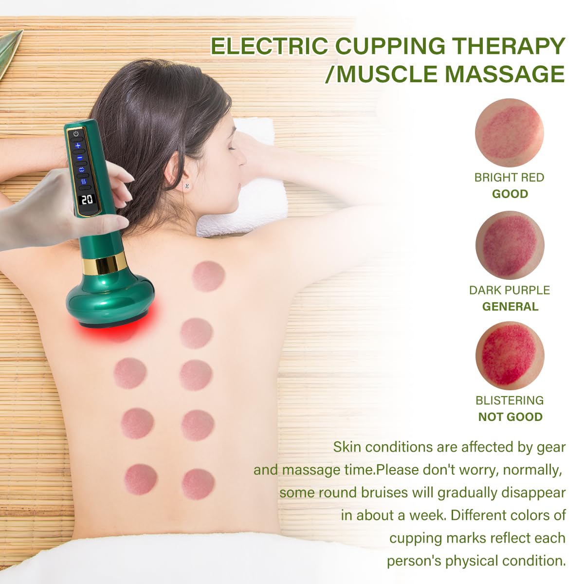Intelligent Negative Pressure Cupping and Scraping Device, 12 Level Adjustable Cupping Massager, Intelligent Cupping Massage Dev