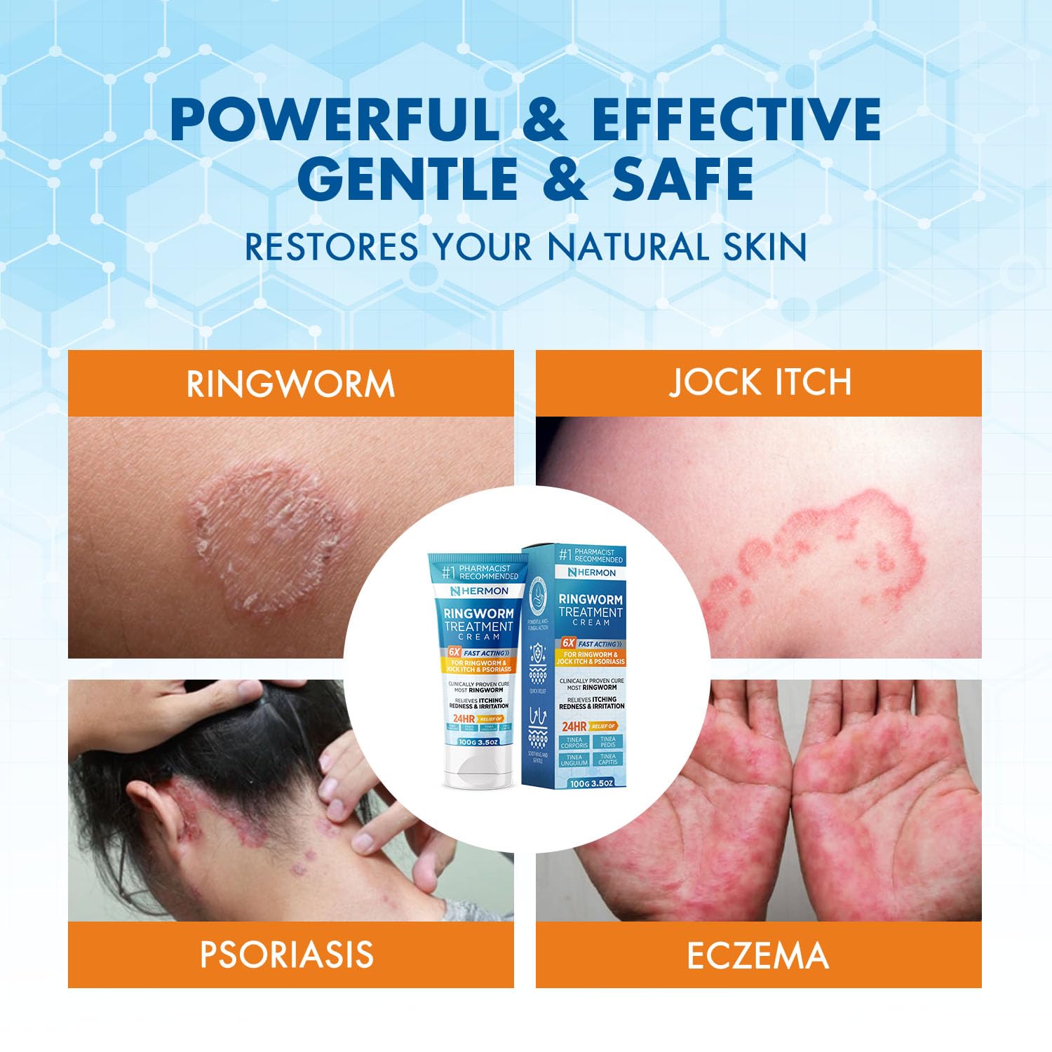 Hermon Powerful Antifungal Ringworm Cream - Effective Treatment for Stubborn Ringworm, Jock Itch, Eczema, Tinea Versicolor, Athl