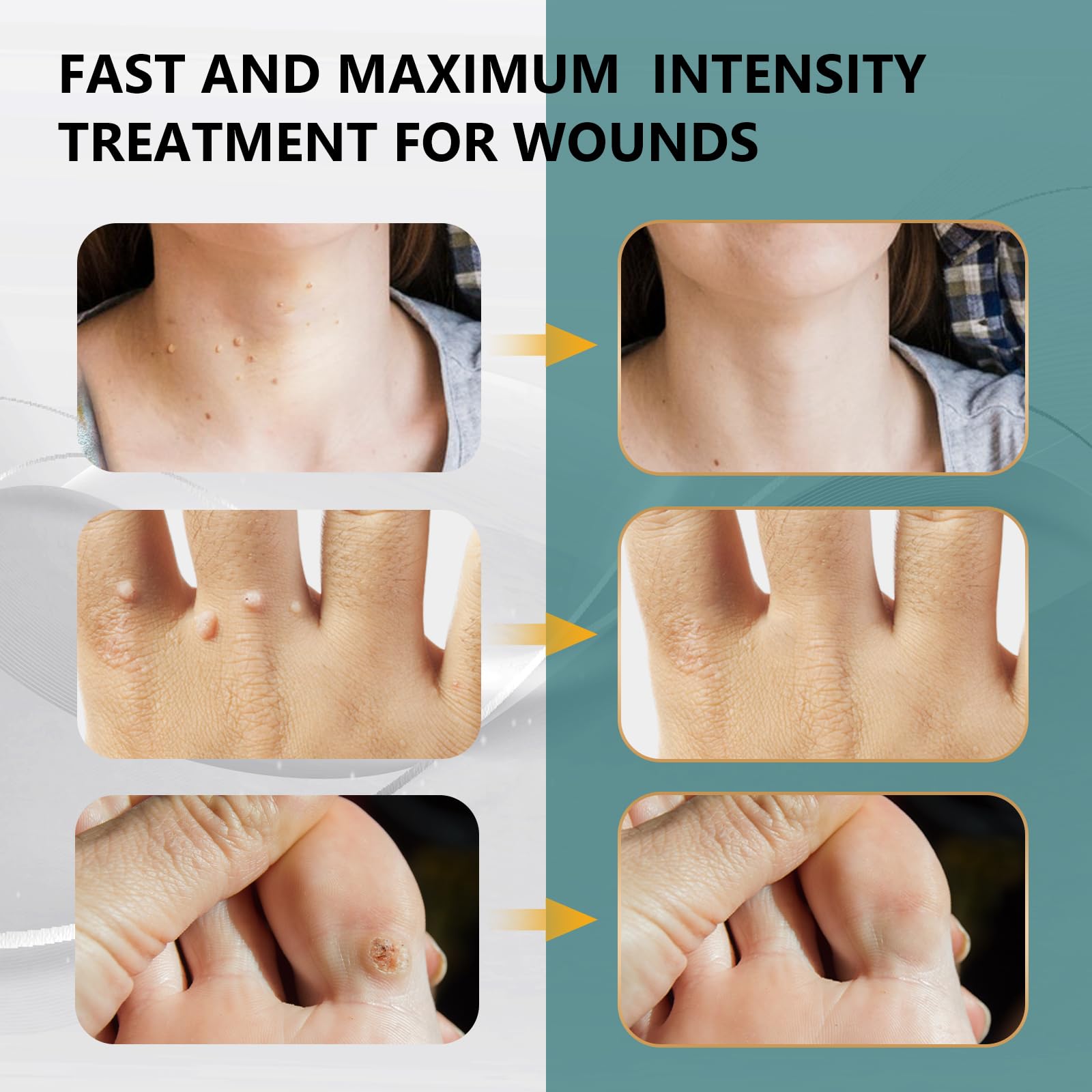 skin tag remover Skin Tag Remover-12% Wart Liquid effective -at home SkinTag Remover-Natural Ingredie Safe for All SkinTypes for