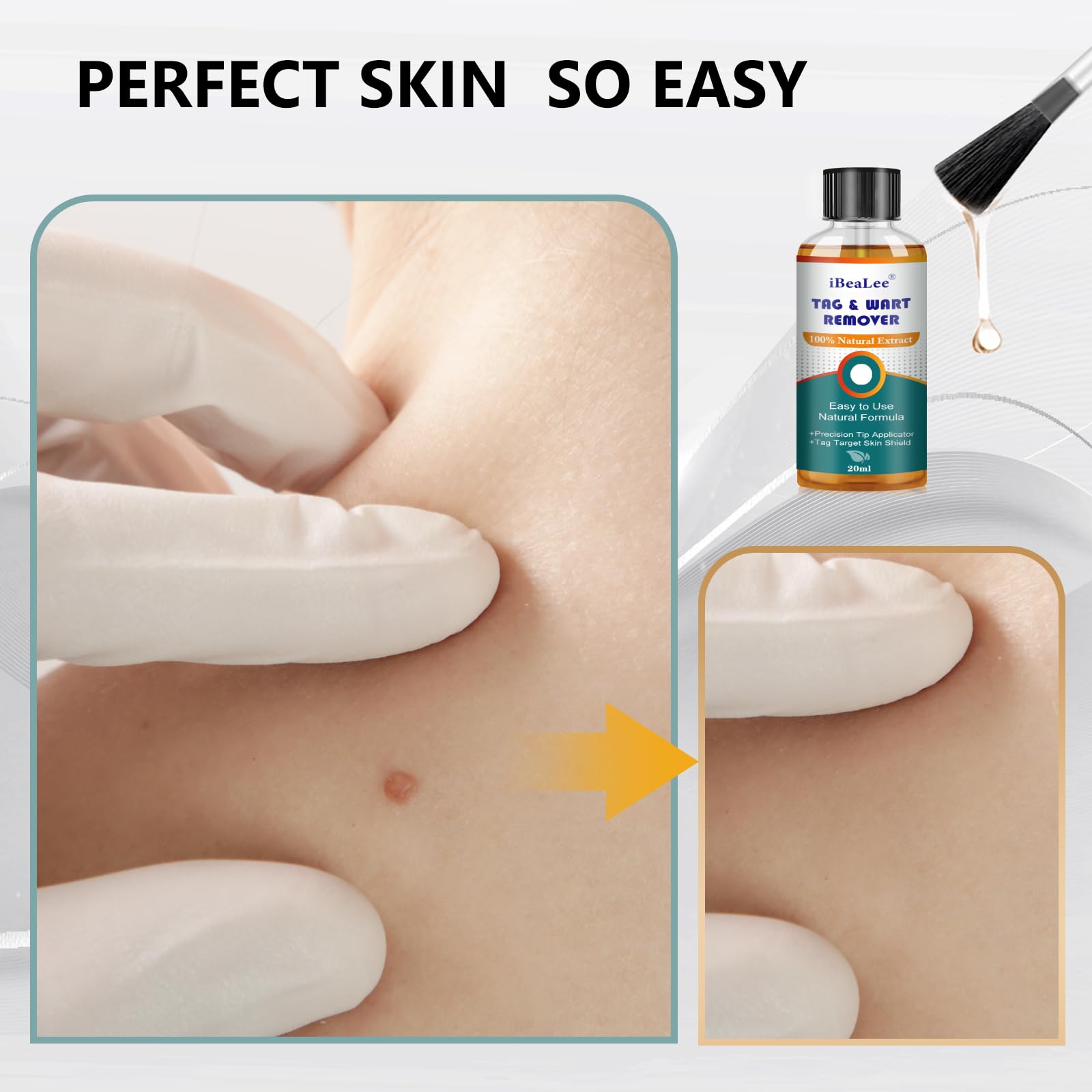 skin tag remover Skin Tag Remover-12% Wart Liquid effective -at home SkinTag Remover-Natural Ingredie Safe for All SkinTypes for