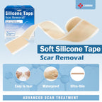 Carbou Medical Silicone Scar Sheets (1.6''x 120''Roll),Soft Silicone Scar Tape,Easy-Tear Silicone Tape for Scars Treatment,Profe