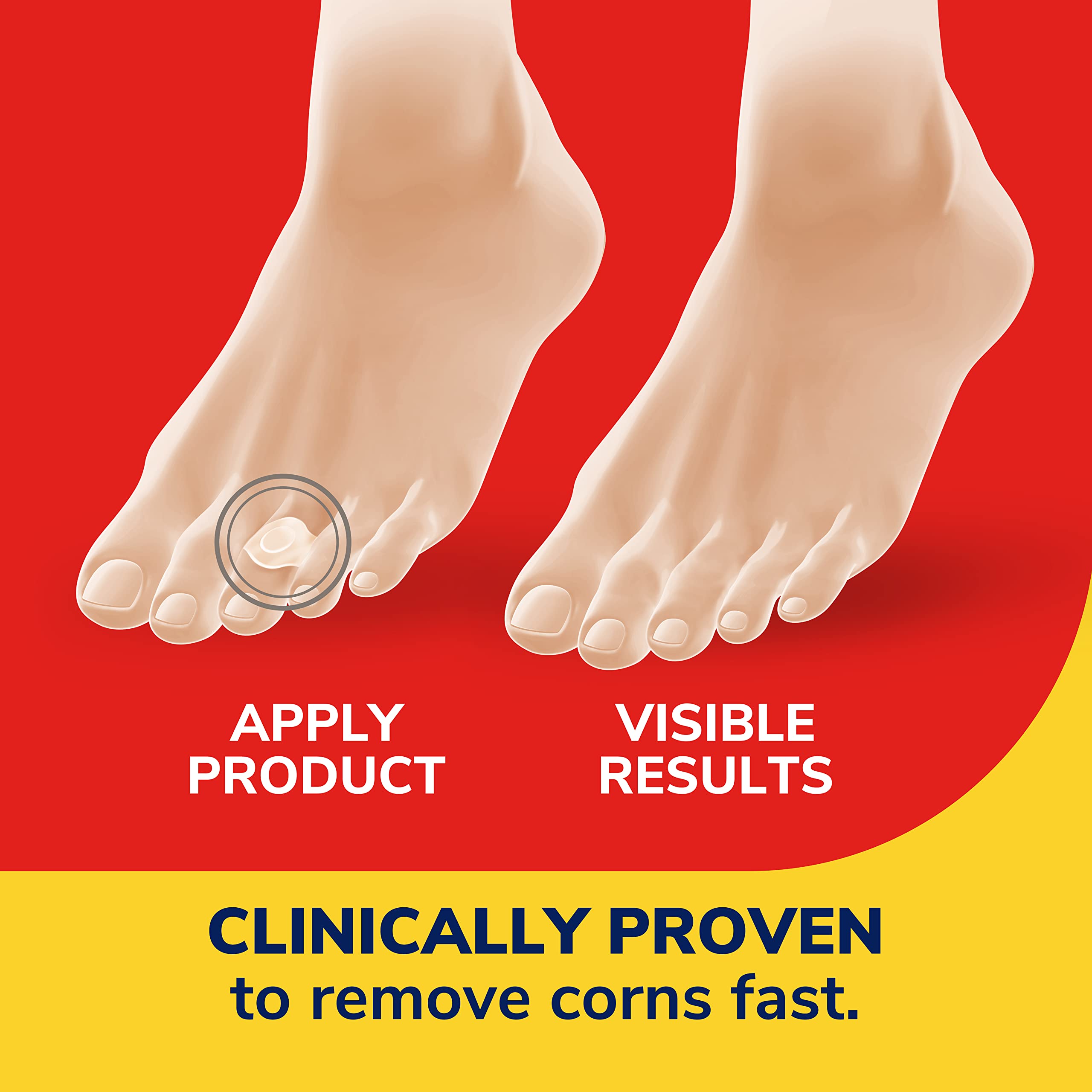 Dr. Scholl 's Corn REMOVERS Seal & Heal Bandage with Hydrogel Technology, 6 ct // Removes Corns Fast and Provides Cushioning Pro