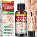 E-Bes Toenail Fungus Treatment Extra Strength, Repair Thick Color Damage Fingernail Toe Nail Fungus Treatments, Tea Tree Oil Eas