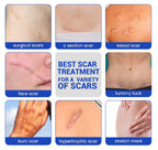Silicone Scar Sheets Surgical Tape (1.6   x120    Roll) Face Patches Acne Treatment C Section Strips, Skin-Sensitive Medical Gra